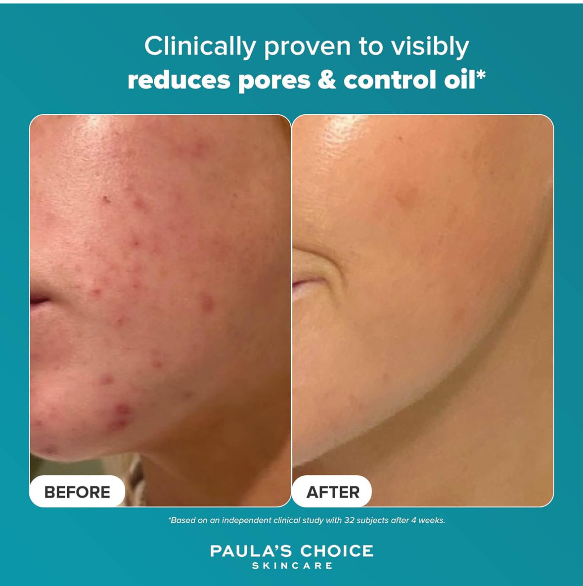 Paula’s Choice Skin Perfecting 2% BHA Liquid Exfoliant 30 ml – Porenverfeinerndes Peeling, Anti-Mitesser, Für Glatte Haut